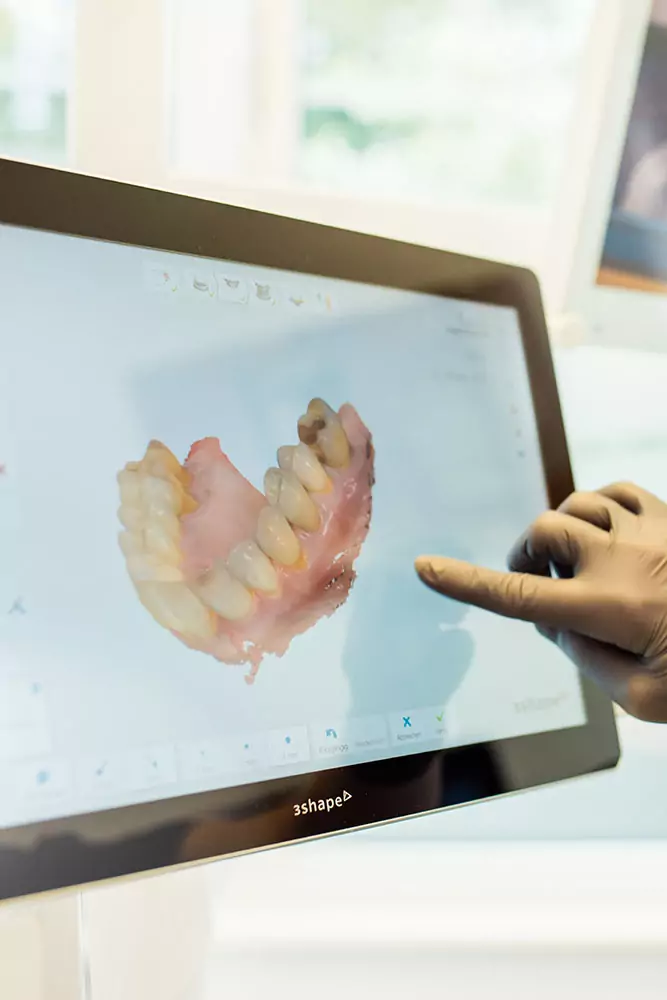 Digitaler 3D Kieferscan forst42 Zahnersatz Brieselang